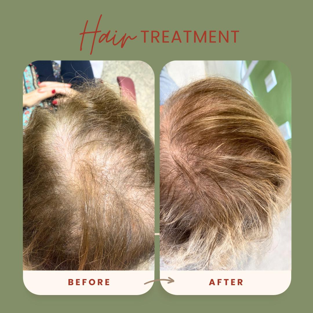 Tratamento capilar — antes e depois